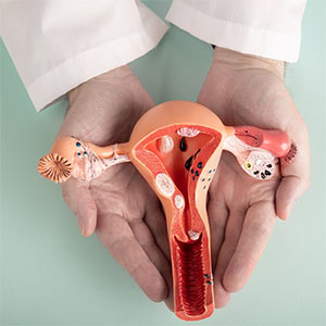 endometriosis