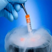 Freezing testicular tissue Freezing testicular tissue