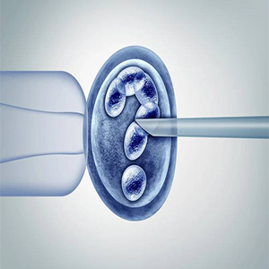 Artificial fertilization with IVF