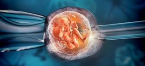In Vitro Fertilization 