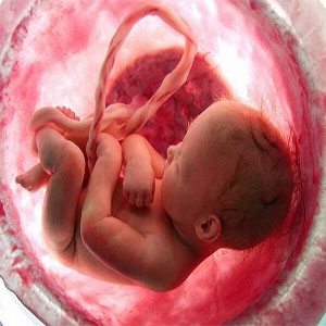 سقط مکرر جنین
