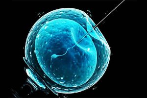 لقاح مصنوعی با IVF 