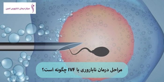 مراحل درمان ناباروری با IVF چگونه است؟