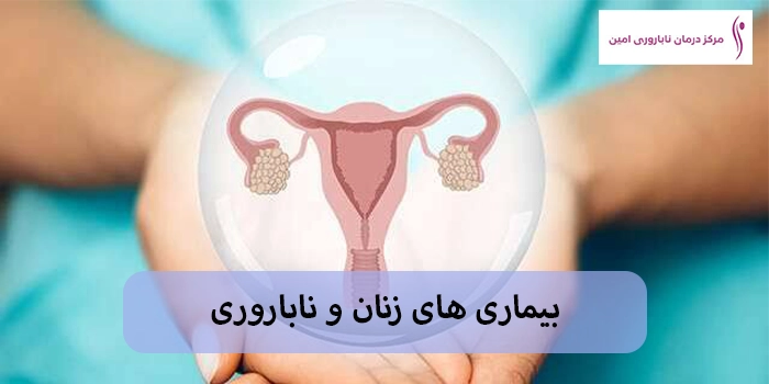 بیماری های زنان و ناباروری؛ کدام بیماری ها بر باروری تأثیر می گذارند؟